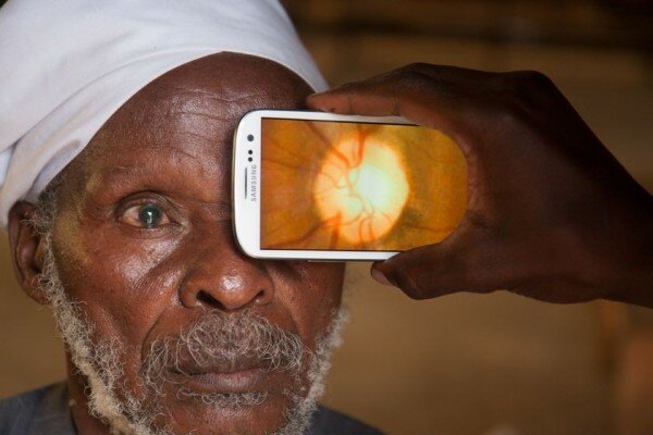 Kenya the first African stop for groundbreaking smartphone eye app